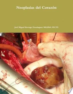 Cover of Neoplasias Del Corazon