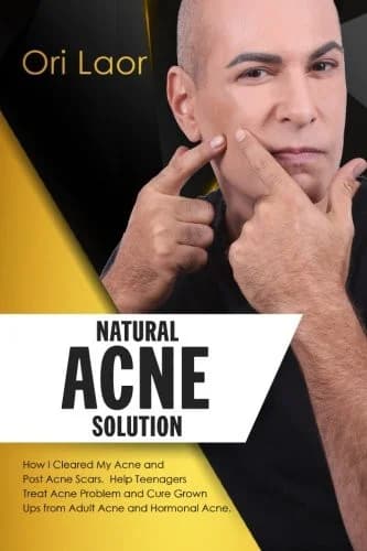 Cover of Natural Acne Solution