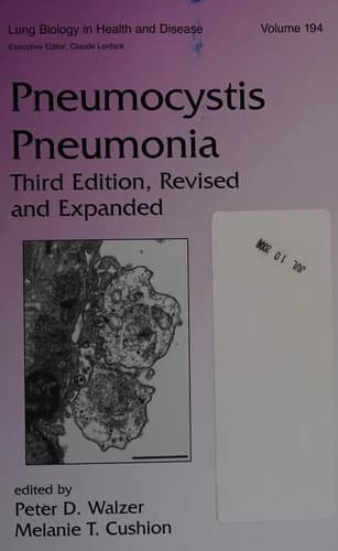 Cover of Pneumocystis Pneumonia
